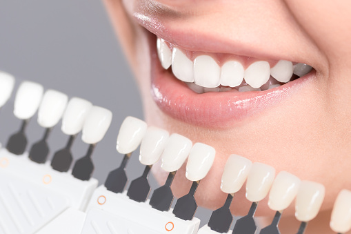12 raisons pour lesquelles vous devez consulter un cabinet dentaire à vaud aujourd’hui