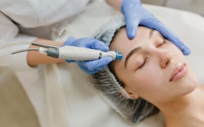 Épilation laser